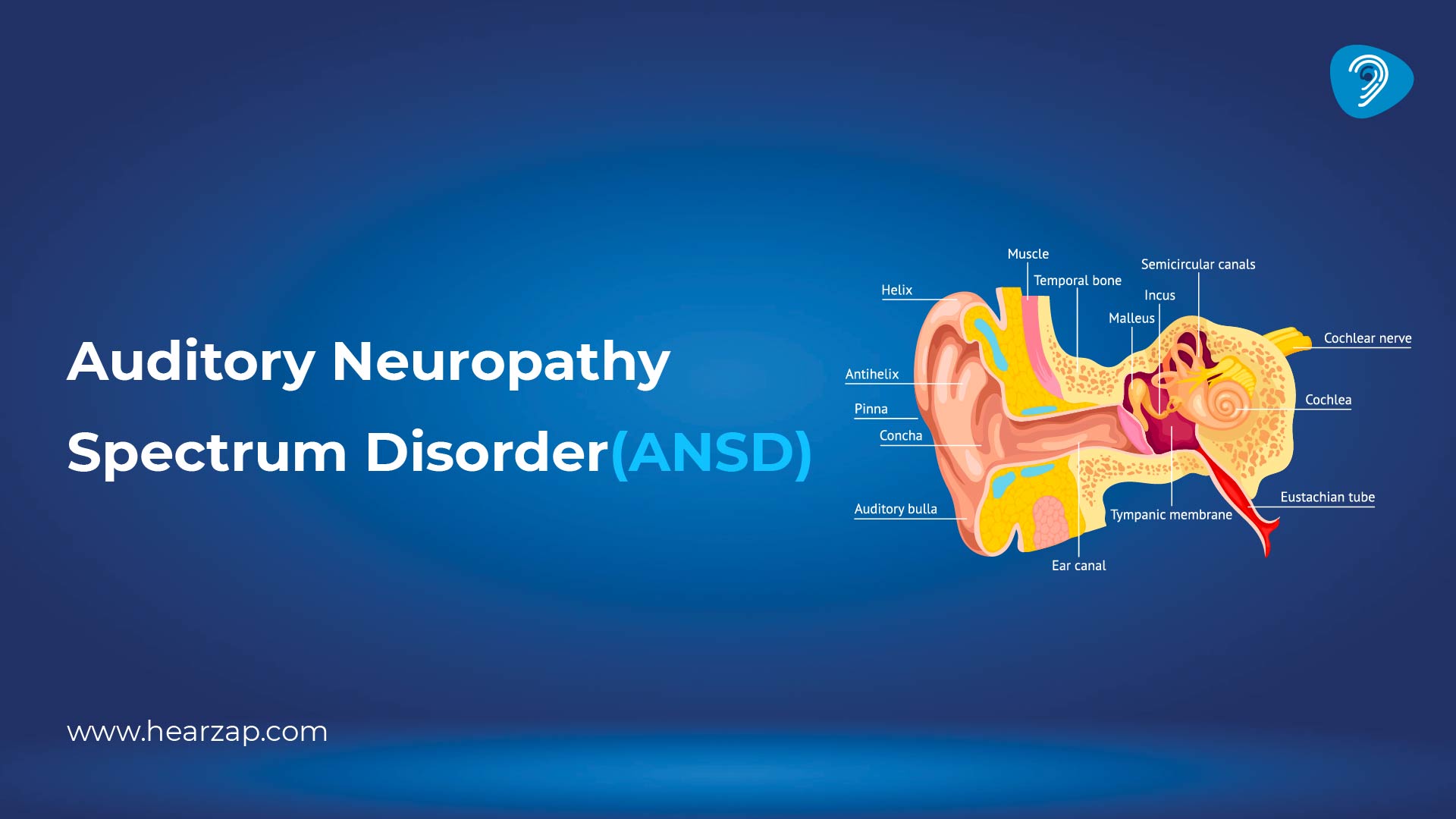 Auditory Neuropathy Spectrum Disorder