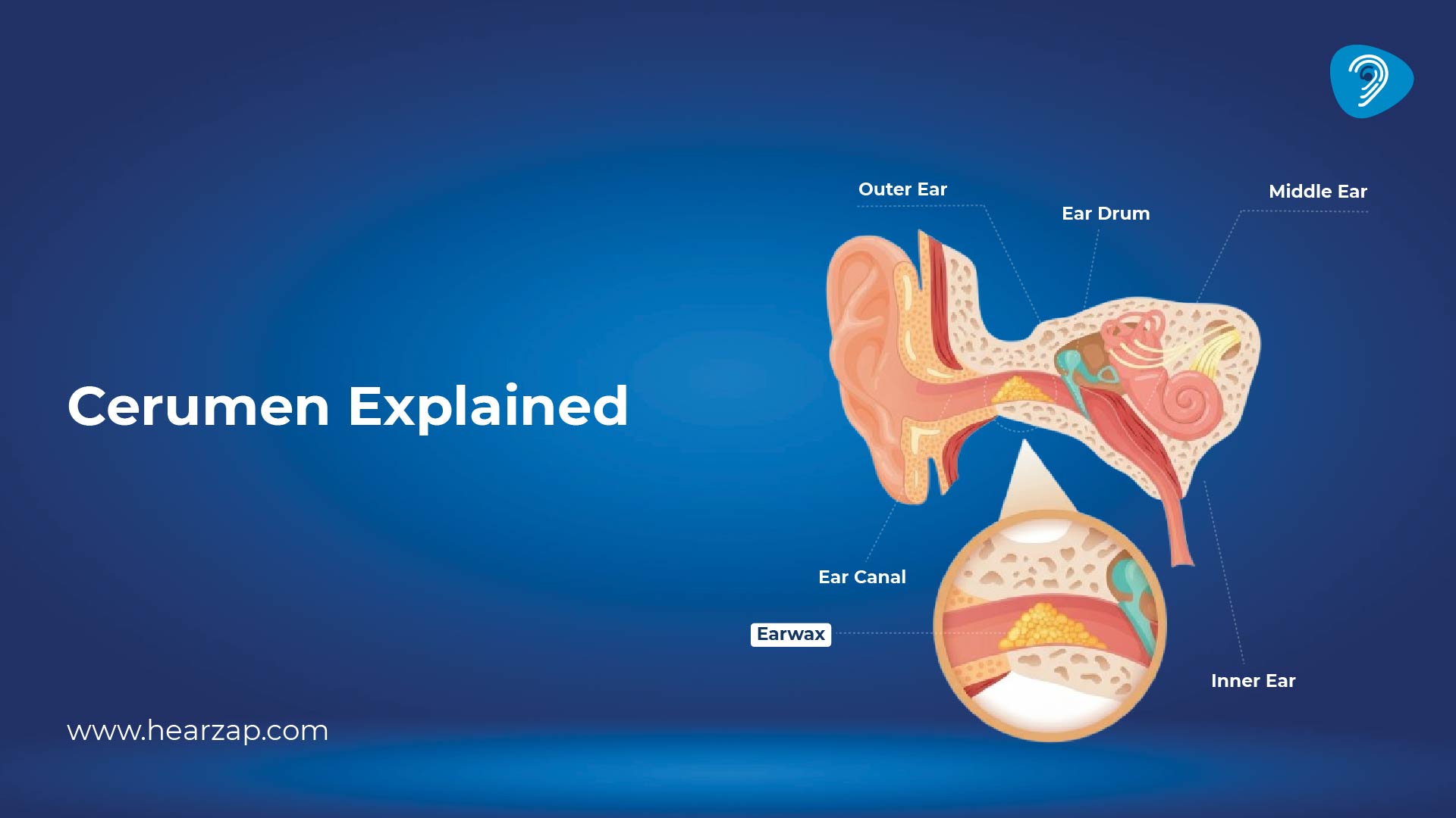 Cerumen (Earwax) Explained