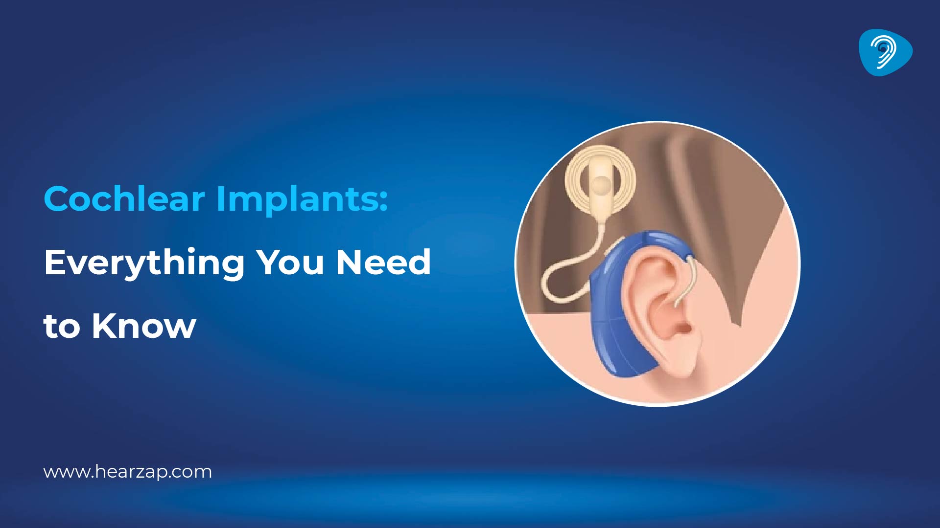 Cochlear Implant