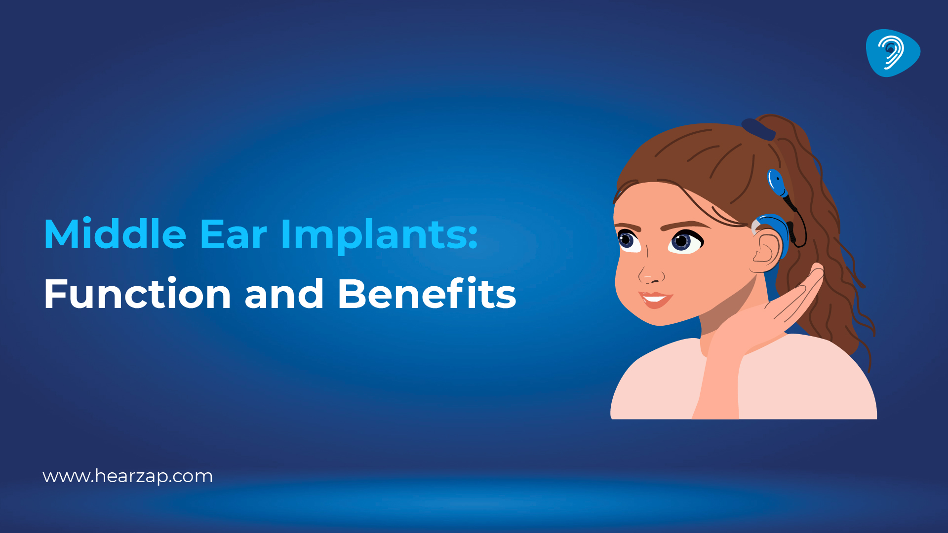Middle Ear Implants