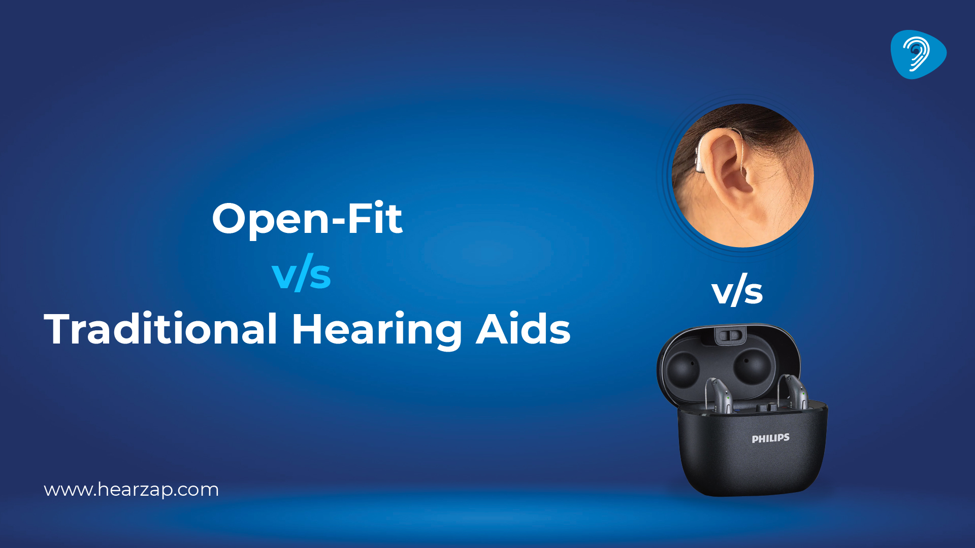 Open-Fit vs Traditional Hearing Aids
