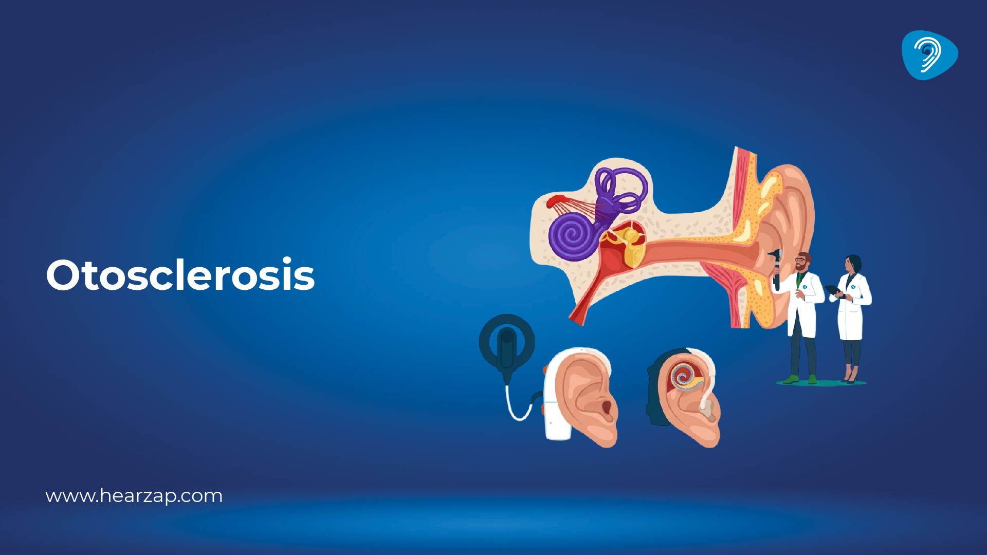 Otosclerosis