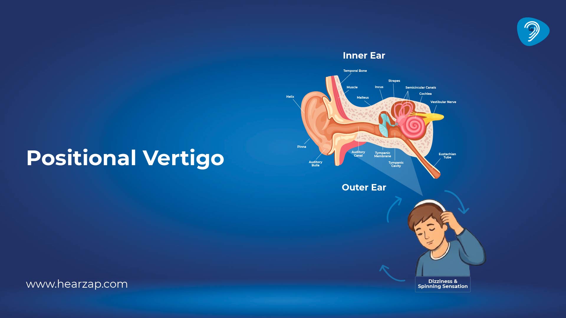 Positional Vertigo