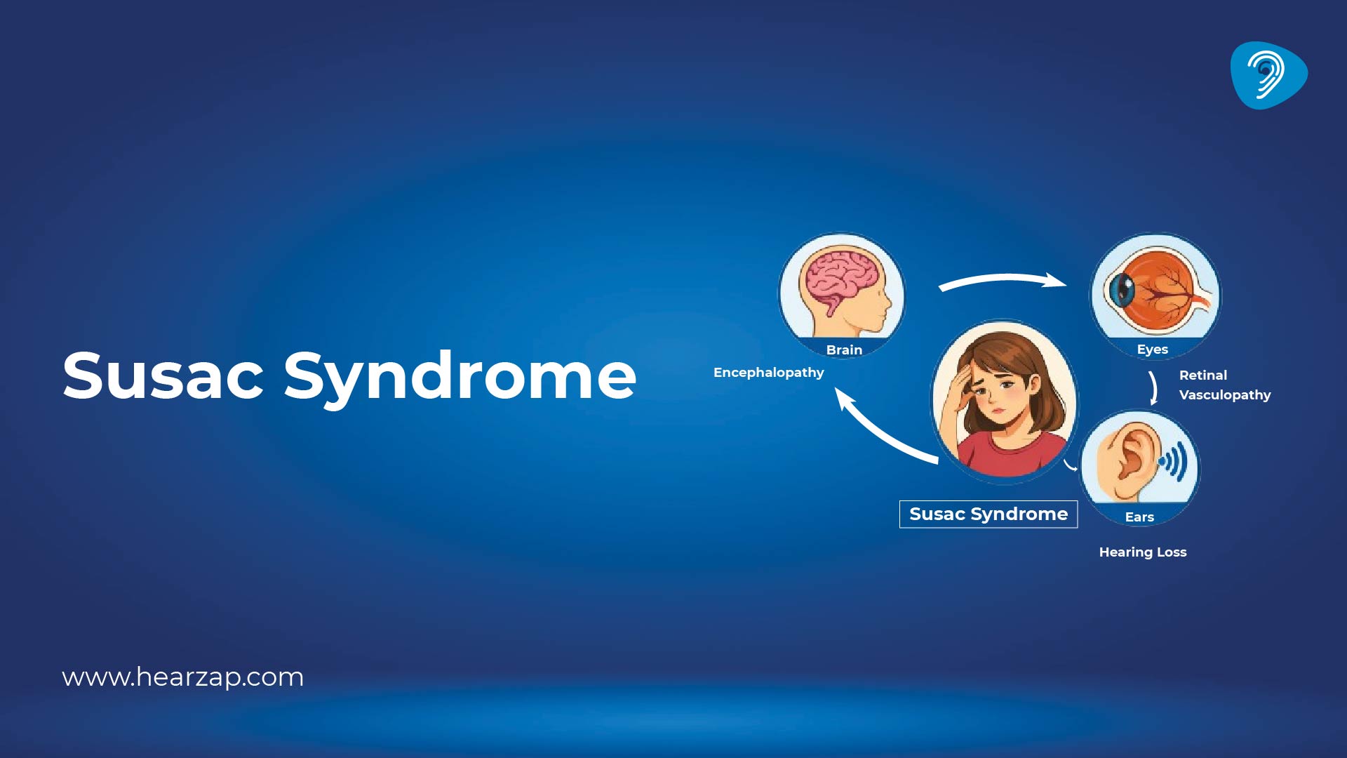Susac Syndrome