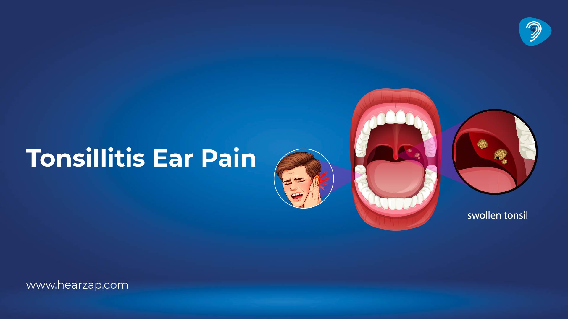 Tonsillitis Ear Pain