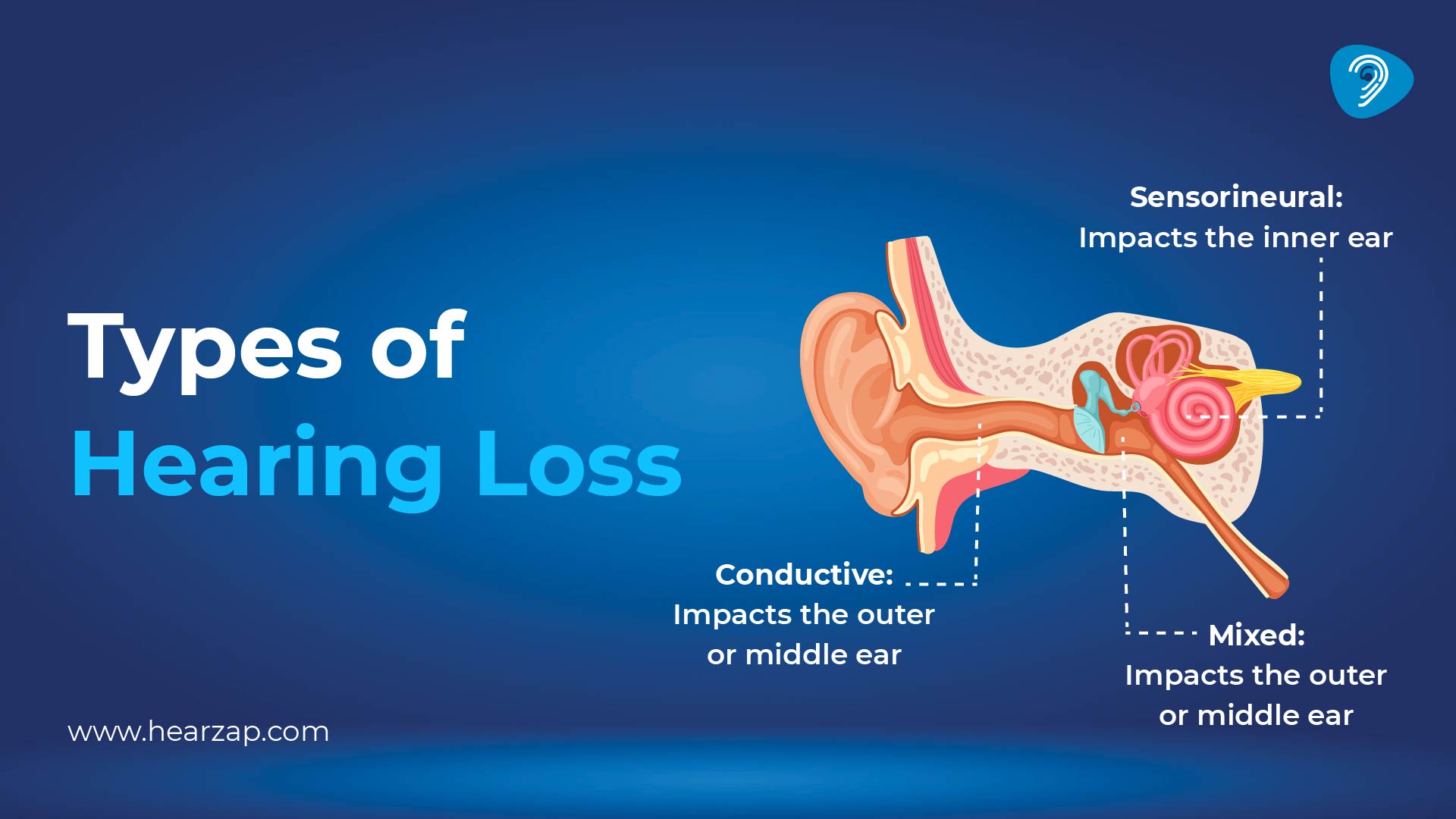 Understanding types of hearing loss