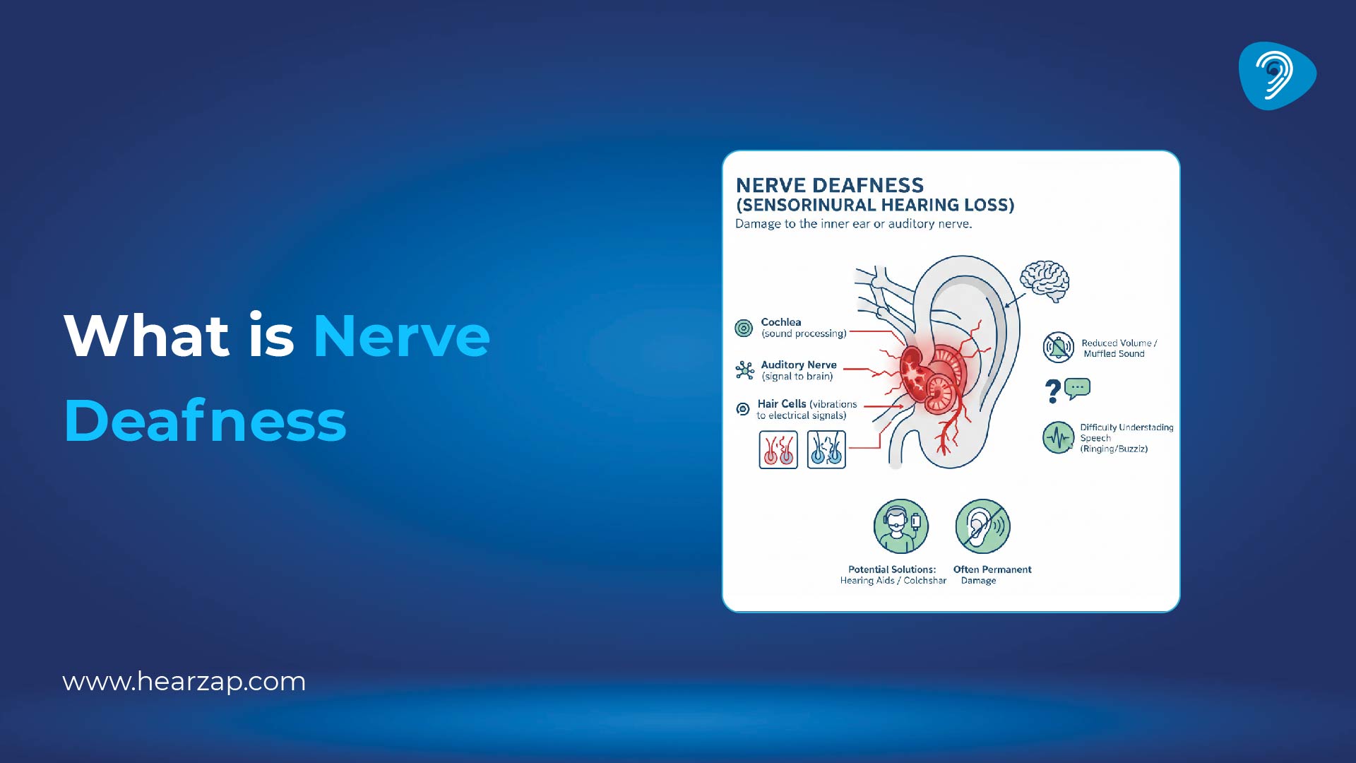 Nerve Deafness