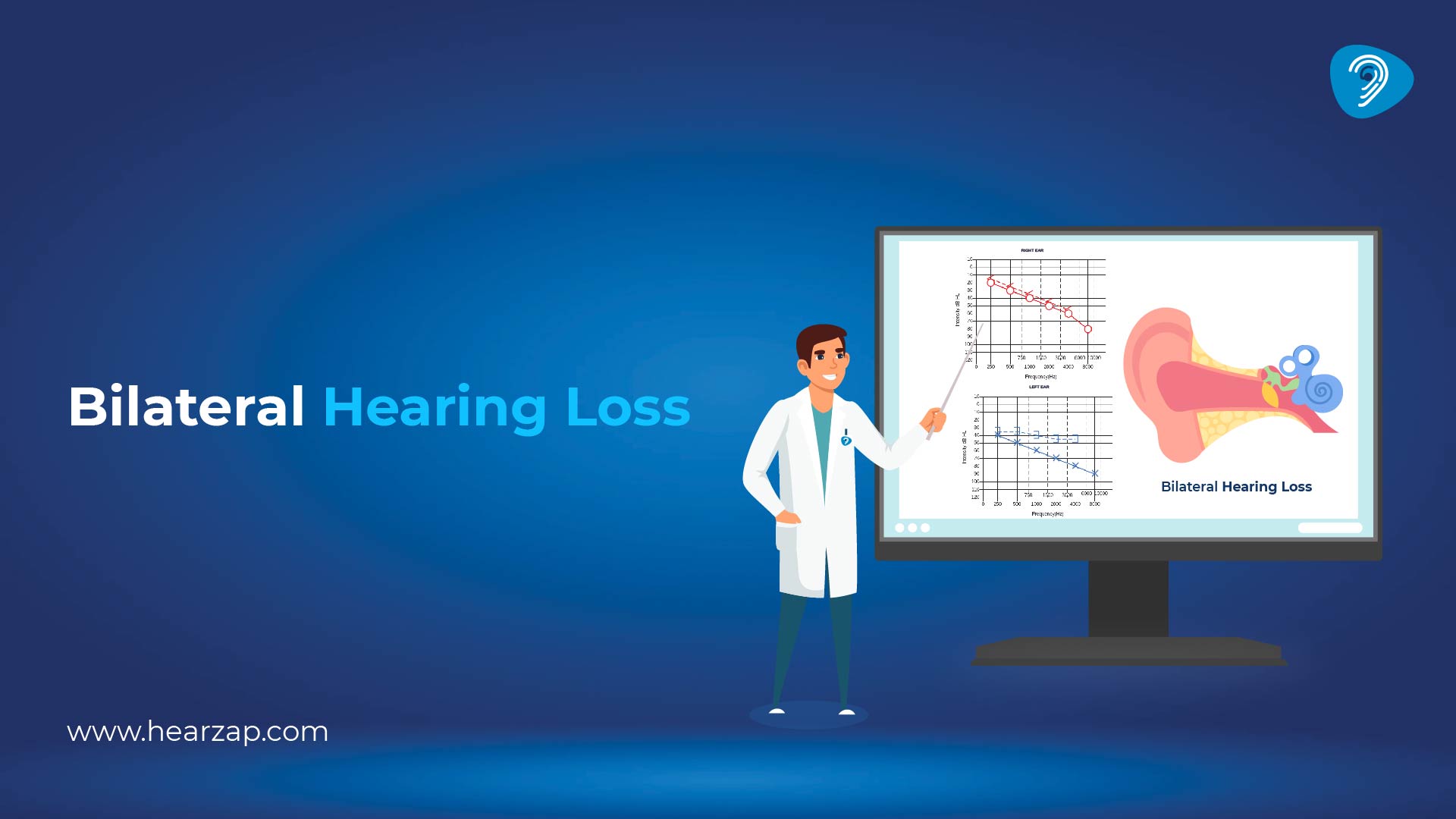Bilateral Hearing Loss