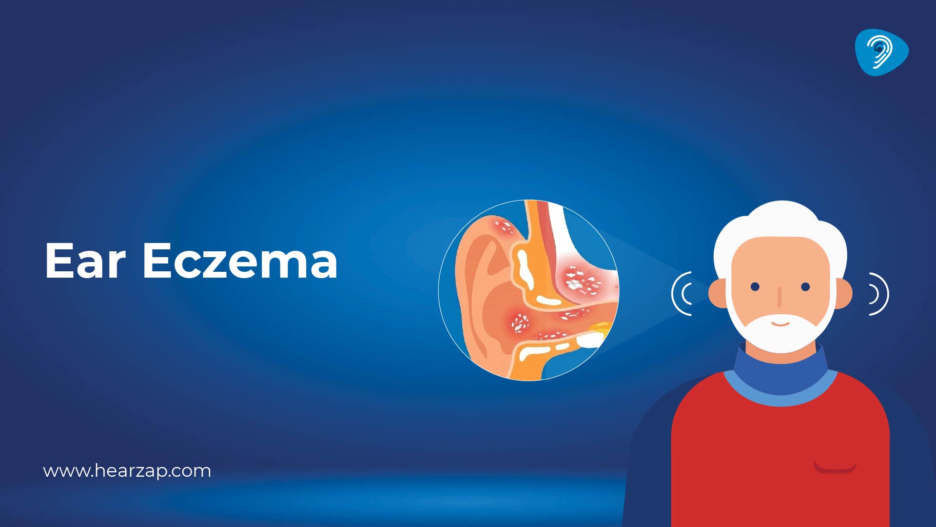 Ear Eczema