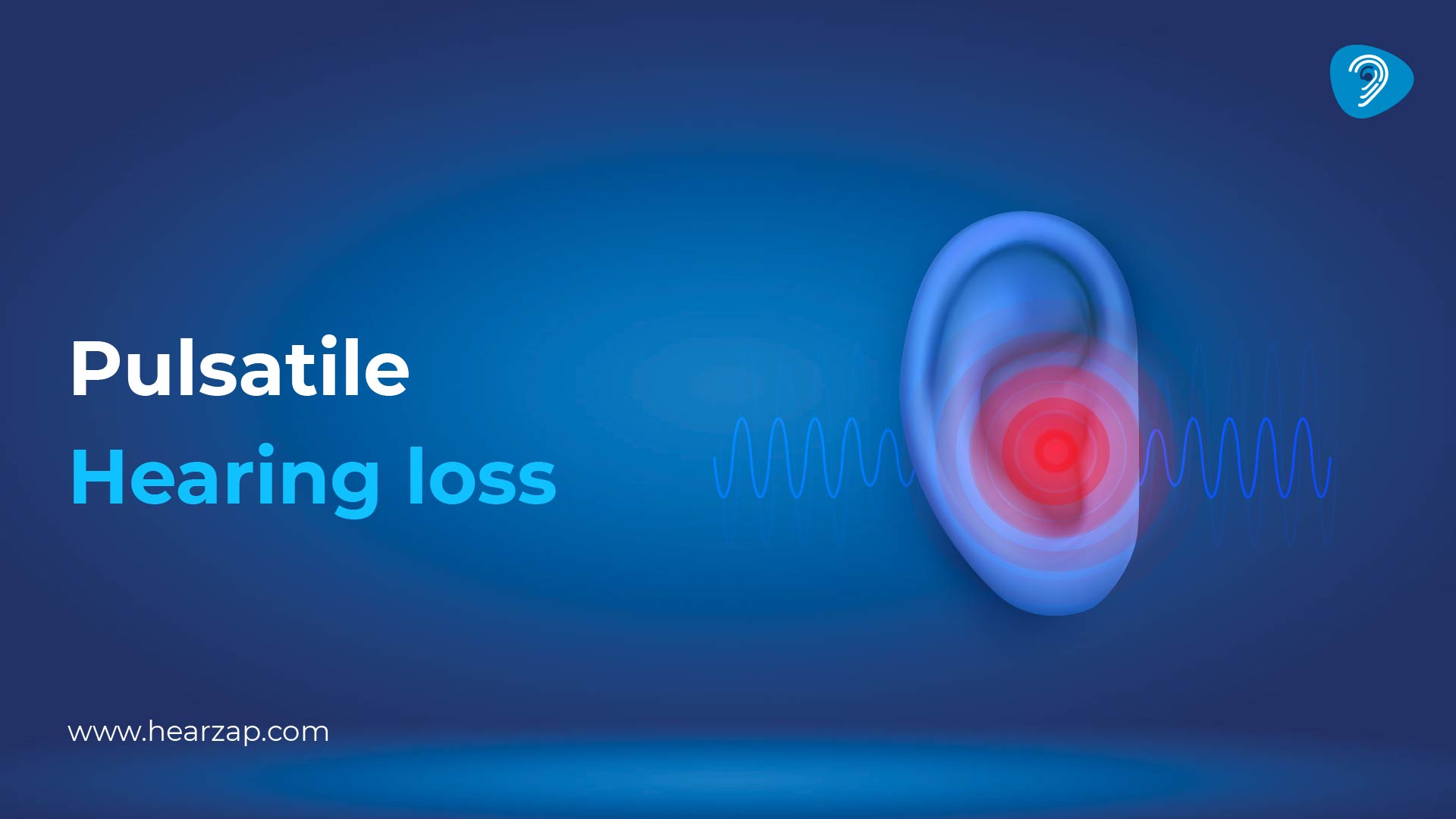 Pulsatile Tinnitus: Causes, Symptoms and Treatment Options