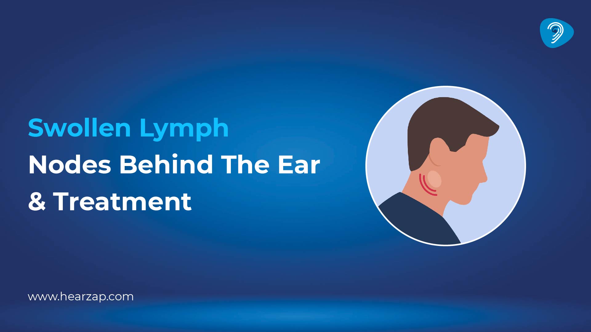 Swollen Lymph Nodes Behind the Ear