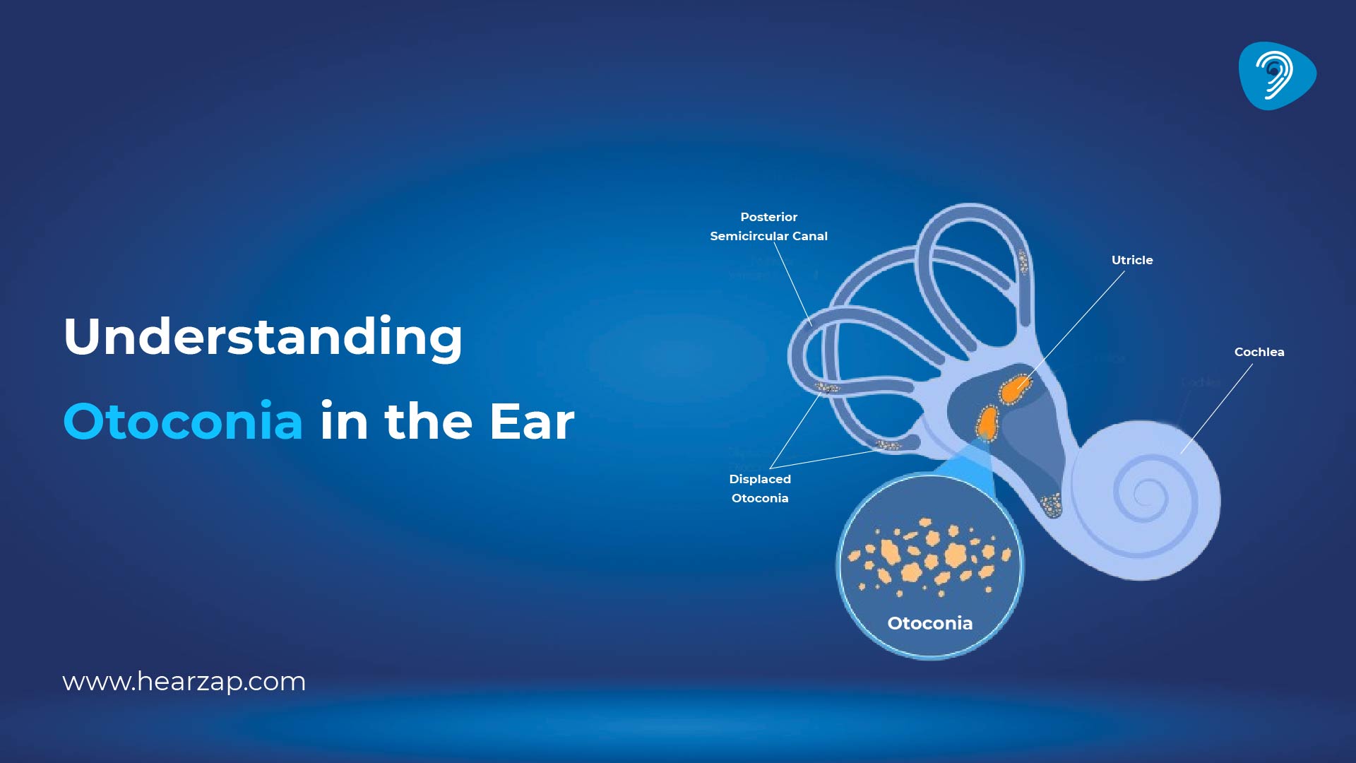 Otoconia in the Ear