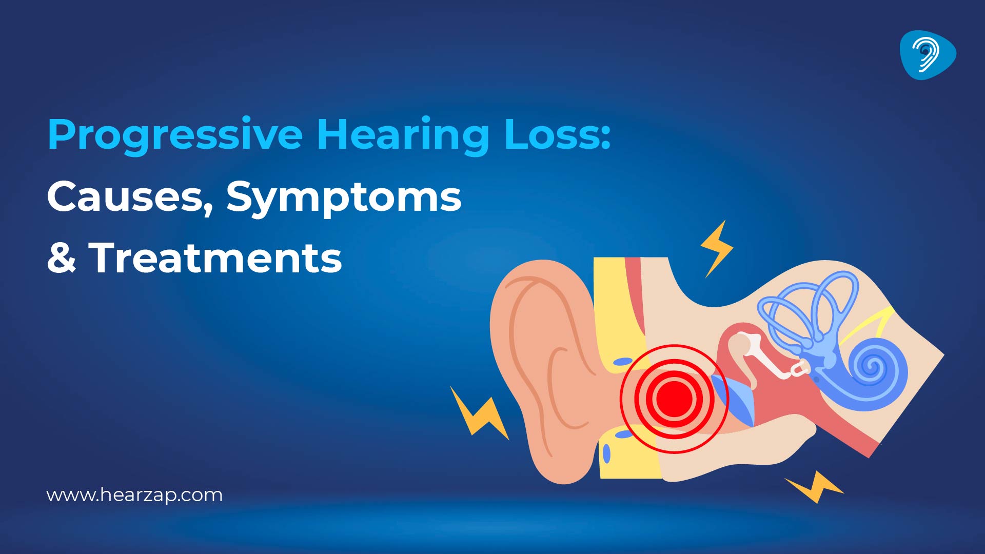 Progressive Hearing Loss