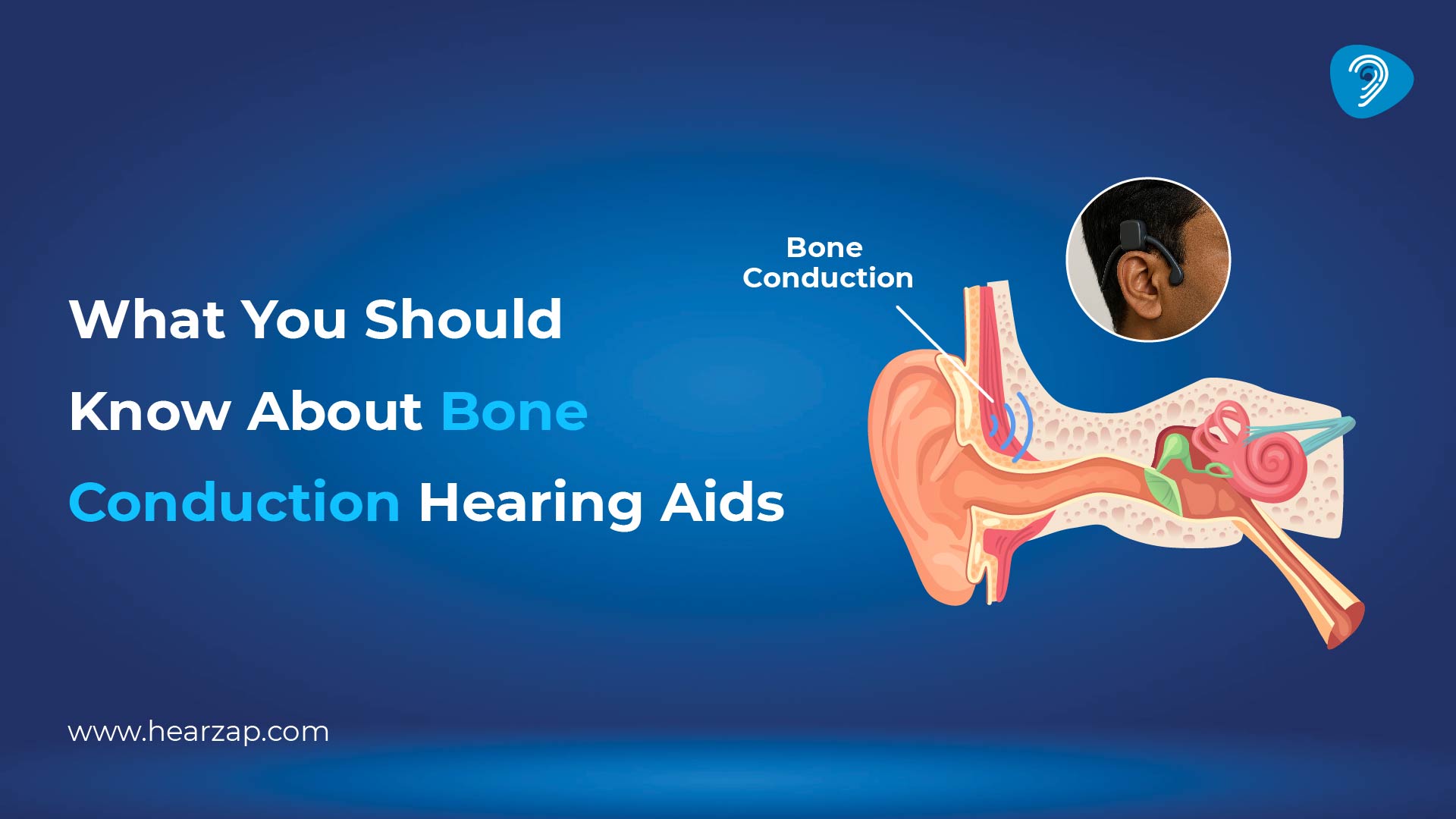 Bone Conduction Hearing Aids 